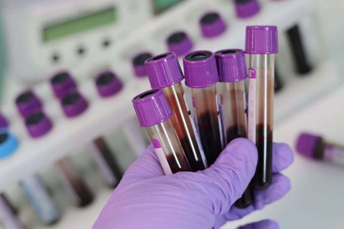 laboratory-3827735_1280