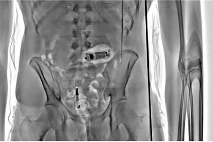 body-scanner-image